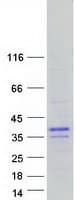 Human BHLHA9 Protein (Recombinant Myc-DDK (Flag))
