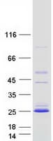 Human C1orf86 Protein (Recombinant Myc-DDK (Flag))