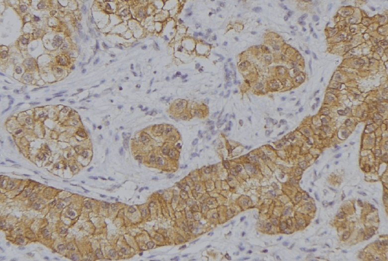 Polyclonal Rabbit anti-Human IFNA2 / Interferon Alpha 2 Antibody (IHC, WB)