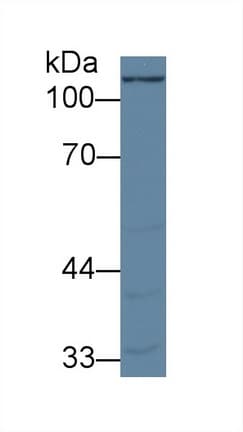 PC / Pyruvate Carboxylase Antibody (aa36-486)