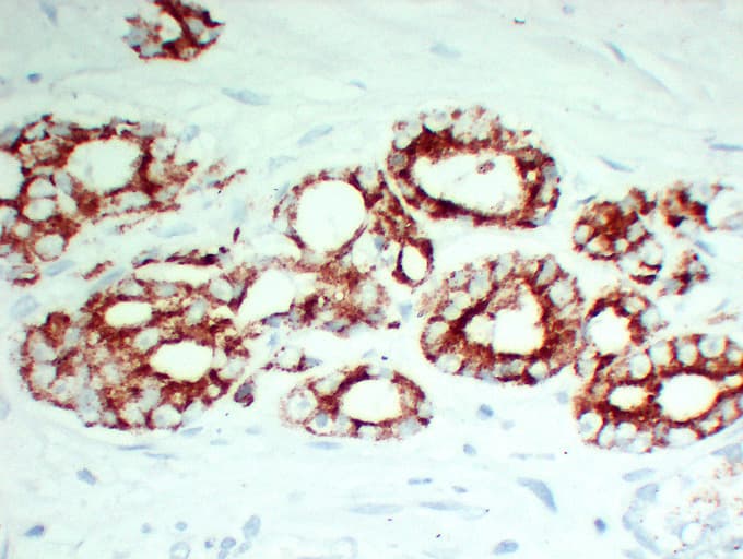 Monoclonal Mouse anti-Human AMACR / P504S Antibody (clone ABT-AMACR, IHC, WB)
