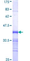 Human CDK12 / CRKRS Protein (Recombinant GST)