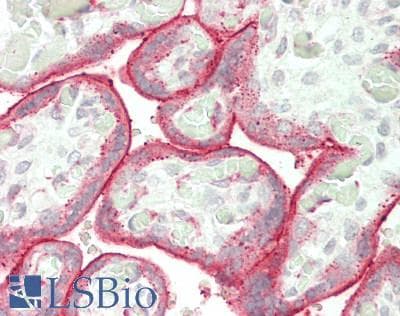 IHC-plus™ RALDH2 / ALDH1A2 Antibody (aa394-443)