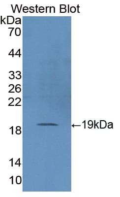 SOD1 / Cu-Zn SOD Antibody (aa2-153, APC)