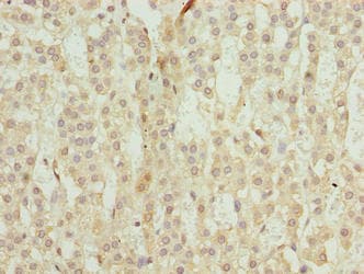 TRAPPC6B Antibody