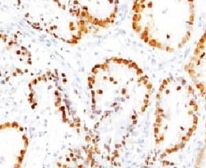 NKX2-1 / Thyroid-Specific TF Antibody (clone HBNK2-1)