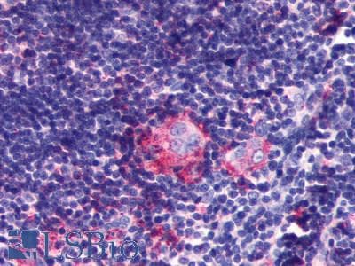 PathPlus™ LPAR6 / P2RY5 / P2Y5 Antibody (Extracellular Domain)