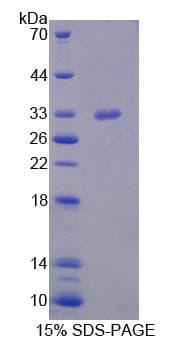 Mouse STK11 / LKB1 Protein (Recombinant His-T7)