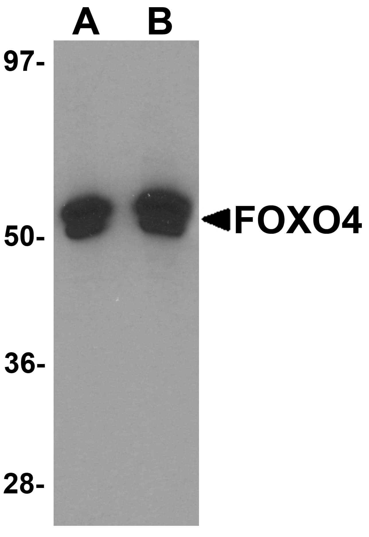 IHC-plus™ Polyclonal Rabbit anti-Human FOXO4 / AFX1 Antibody (IHC, IF, WB)
