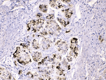 FGG / Fibrinogen Gamma Antibody