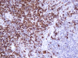 CD20 Antibody (clone OTI1H4)