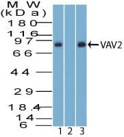 VAV2 Antibody (aa760-810)