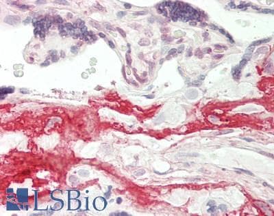 IHC-plus™ Monoclonal Mouse anti-Human NPPB / BNP Antibody (clone 2D11, IHC, WB)