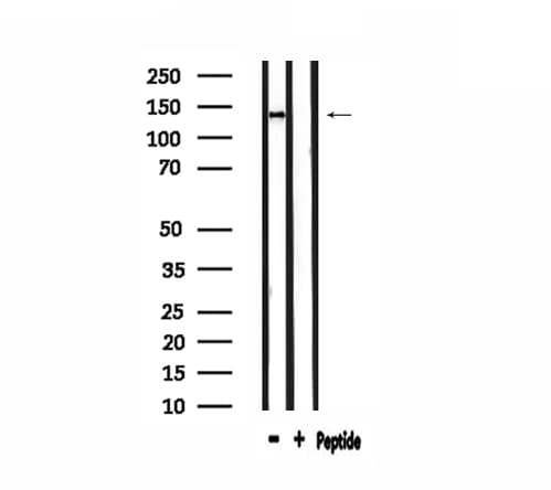 ADAMTS19 Antibody