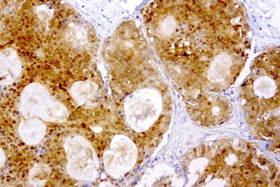 TP / Thymidine Phosphorylase Antibody (aa311-482, clone UMAB97)
