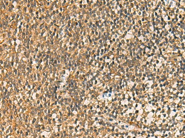 Polyclonal Rabbit anti-Human C17orf70 Antibody (IHC)