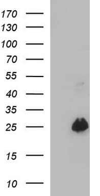 VEGFB Antibody (clone OTI1H9)