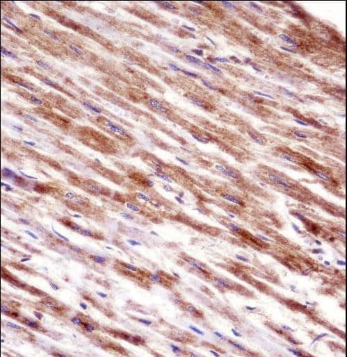 HSPBP1 Antibody (aa69-97)