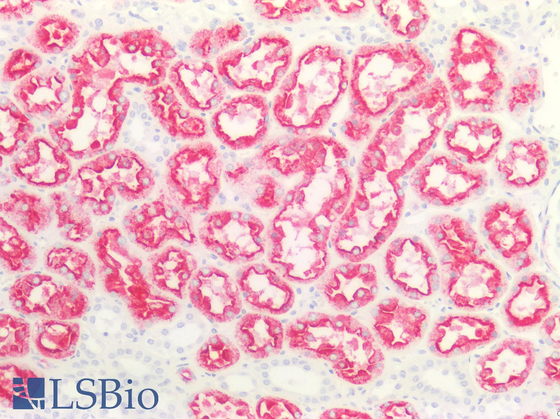 PathPlus™ Renal Cell Carcinoma Antibody (clone PN-15)