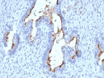 PODXL / Podocalyxin Antibody (clone PODXL/2185)