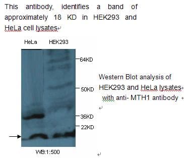 IHC-plus™ NUDT1 / MTH1 Antibody