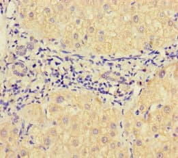 Polyclonal Rabbit anti-Human VAMP1 / VAMP-1 Antibody