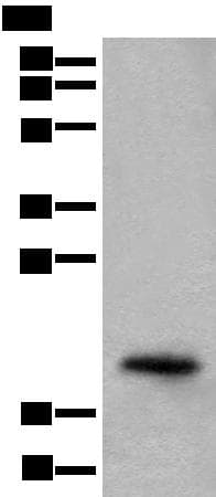 CRYGS Antibody