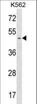 PME-1 / PPME1 Antibody (aa351-379)