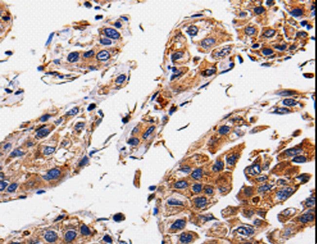 RAB41 Antibody