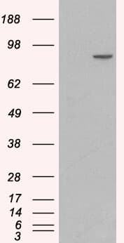 IHC-plus™ Polyclonal Goat anti-Human CTNNA1 / Catenin Alpha-1 Antibody (aa871-883, IHC, WB)
