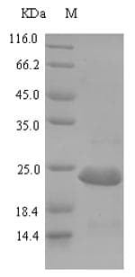 Escherichia coli Carbon storage regulator Protein (Recombinant 6His-SUMO, N-terminus)