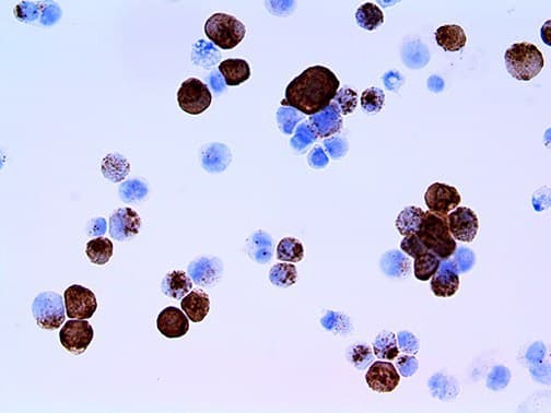 HSV-2 / Herpes Simplex Virus 2 Antibody