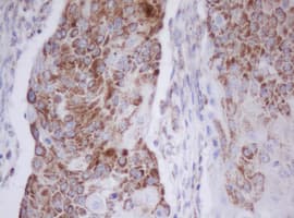 IF3mt / MTIF3 Antibody (clone OTI4G2)