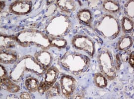 GLB1 / Beta-Galactosidase Antibody (clone OTI1C9)