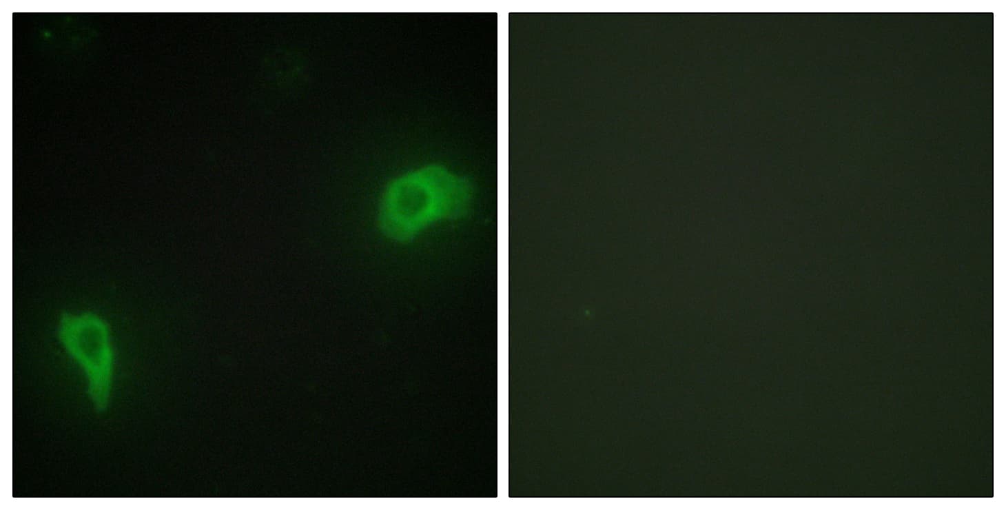 Polyclonal Rabbit anti-Human DOK7 Antibody (aa10-59, IHC, IF, WB)