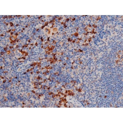 CDC25A Antibody (phospho-Ser75)