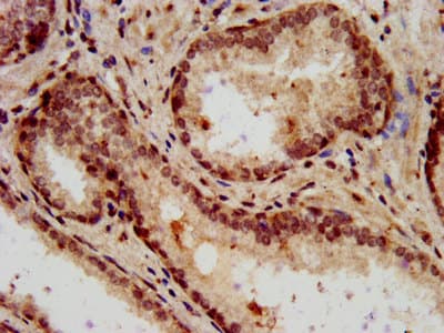 Polyclonal Rabbit anti-Human HIST1H3A Antibody (IHC, IF, WB)