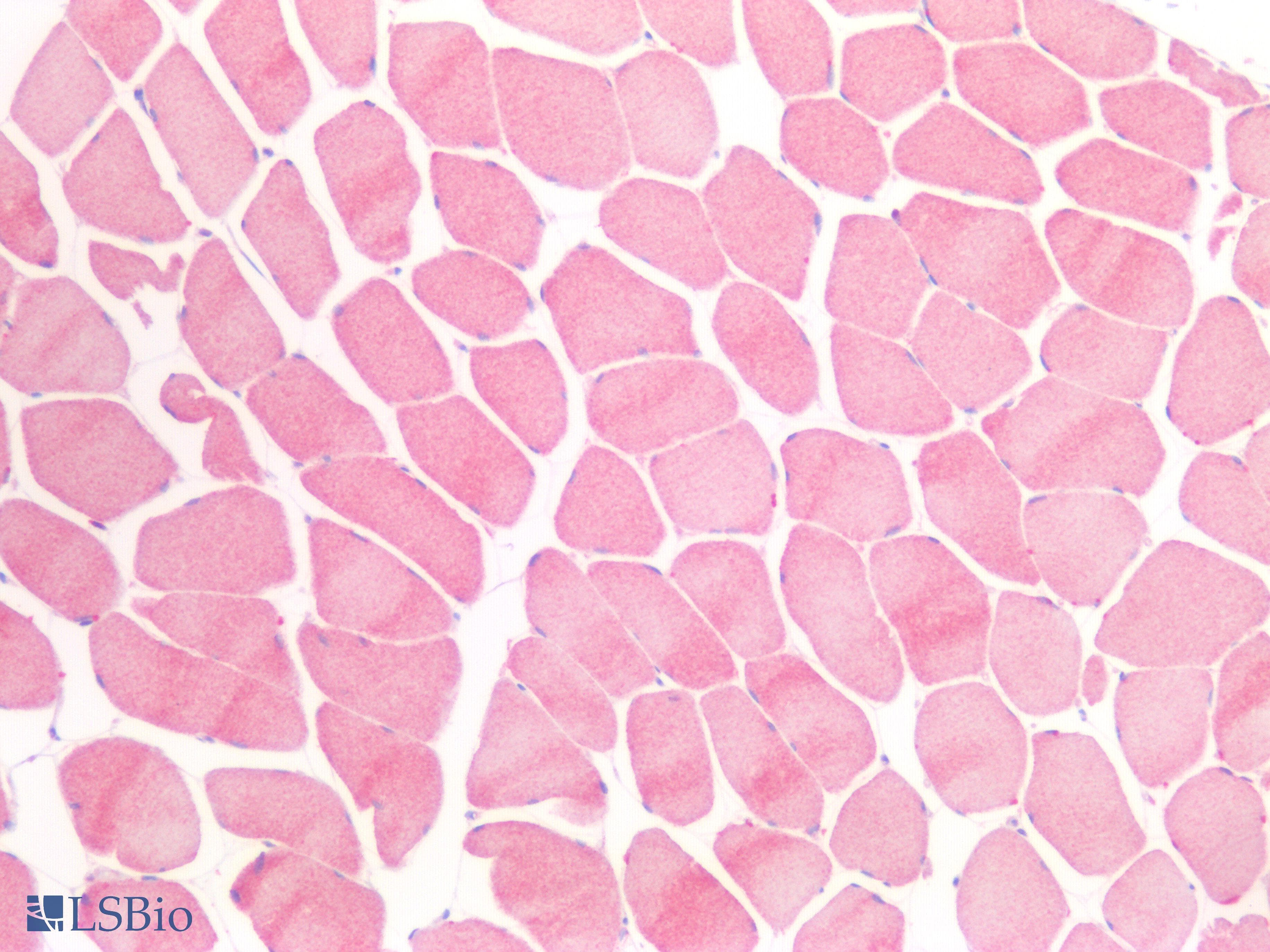 IHC-plus™ Monoclonal Mouse anti-Human DMPK / DM Antibody (clone 2F7, IHC, WB)