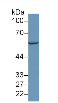 PPOX Antibody (aa9-300, PE)