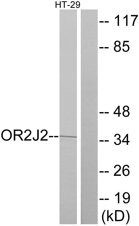 OR2J2 Antibody (aa263-312)