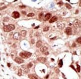 SUMO2 Antibody (aa63-93)