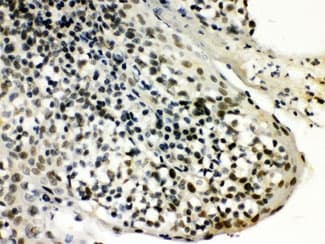 Polyclonal Rabbit anti-Human SNRPN Antibody (IHC, WB)