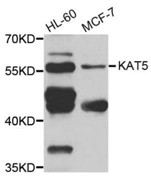 Polyclonal Rabbit anti-Human KAT5 / TIP60 Antibody (IHC, IF, WB)