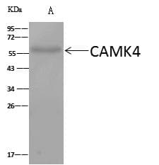 CAMK4 / CaMK IV Antibody (Preservative Free)