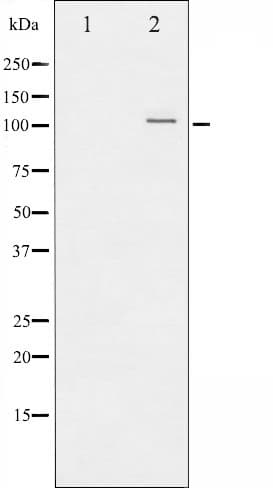Polyclonal Rabbit anti-Human NFKB2 Antibody (phospho-Ser872, IF, WB)