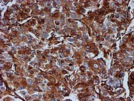 TUBB4 / Tubulin Beta 4 Antibody (clone OTI3F1, Carrier-free)