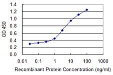 PathPlus™ Monoclonal Mouse anti-Human COL1A1 / Collagen I Alpha 1 Antibody (clone 3G3, IHC, WB)