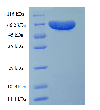 Human ETFDH Protein (Recombinant His)