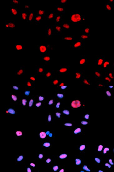 MDM2 Antibody (phospho-Ser166)