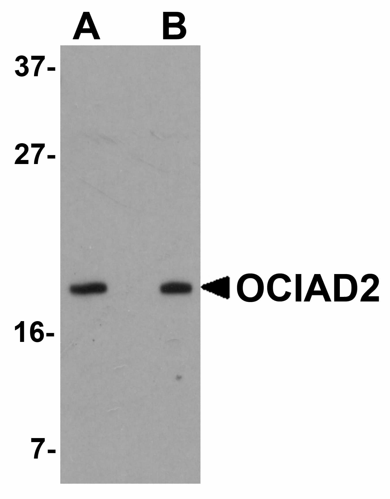 IHC-plus™ Polyclonal Rabbit anti-Human OCIAD2 Antibody (IHC, IF, WB)